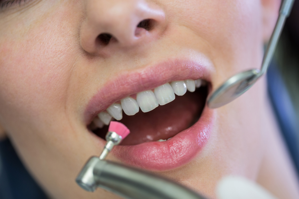 Closeup of a dental hygiene procedure with dental tools close to a woman's mouth