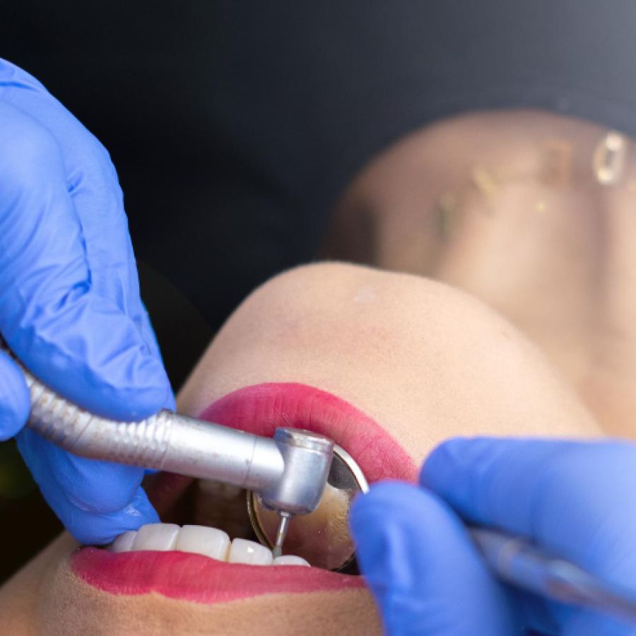 Dentist working on a person's mouth using a drill and mirror, they are wearing blue latex gloves